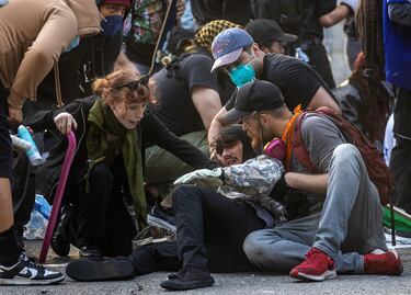 Un manifestante hace una mueca de dolor tras ser alcanzado por un proyectil "menos letal" disparado por agentes de policía durante una protesta contra las redadas federales de inmigración en el centro de Los Ángeles.