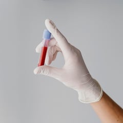 Maria Luisa Trimiño, ginecóloga, da la clave sobre una de las infecciones más comunes en verano: “Es la base de todo”