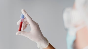 Maria Luisa Trimiño, ginecóloga, da la clave sobre una de las infecciones más comunes en verano: “Es la base de todo”