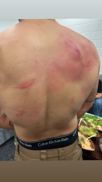El cantante Bad Bunny quiso mostrar las heridas en su espalda tras la disputa de su combate ante Damian Priest en Backlash de la WWE en Puerto Rico.