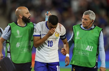 Kylian Mbappé se retira lesionado del campo por el fuerte impacto que recibe en la nariz.