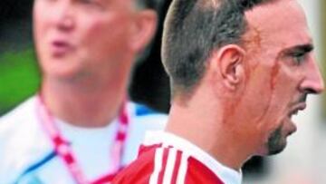 <b>MOLESTO. </b>Ribéry no se ejercitó ayer y el jueves se retiró del entrenamiento antes de su finalización.