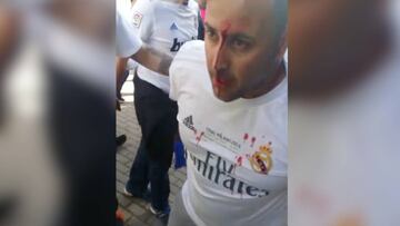 La terrible escena en la que un fan del Madrid fue agredido
