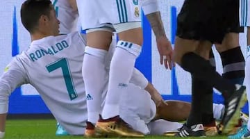 Ronaldo indicates the stud marks on his leg