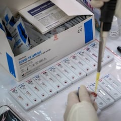 Prueban el kit de bolsillo para hacer un autotest con un resultado en 45 minutos