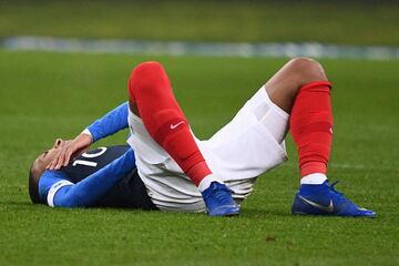 Lesión de Kylyan Mbappé.