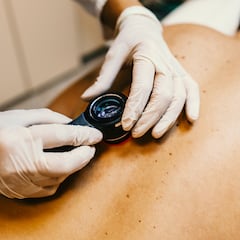 Dermatóloga acude a un programa de TV en directo y el presentador acaba descubriendo que tiene cáncer de piel