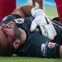 Lucero Álvarez salió lesionado en el partido ante Cruz Azul