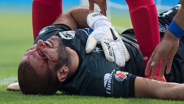 Lucero Álvarez salió lesionado en el partido ante Cruz Azul