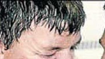 En la imagen, O'Driscoll tras sufrir fractura de pómulo por agresión.