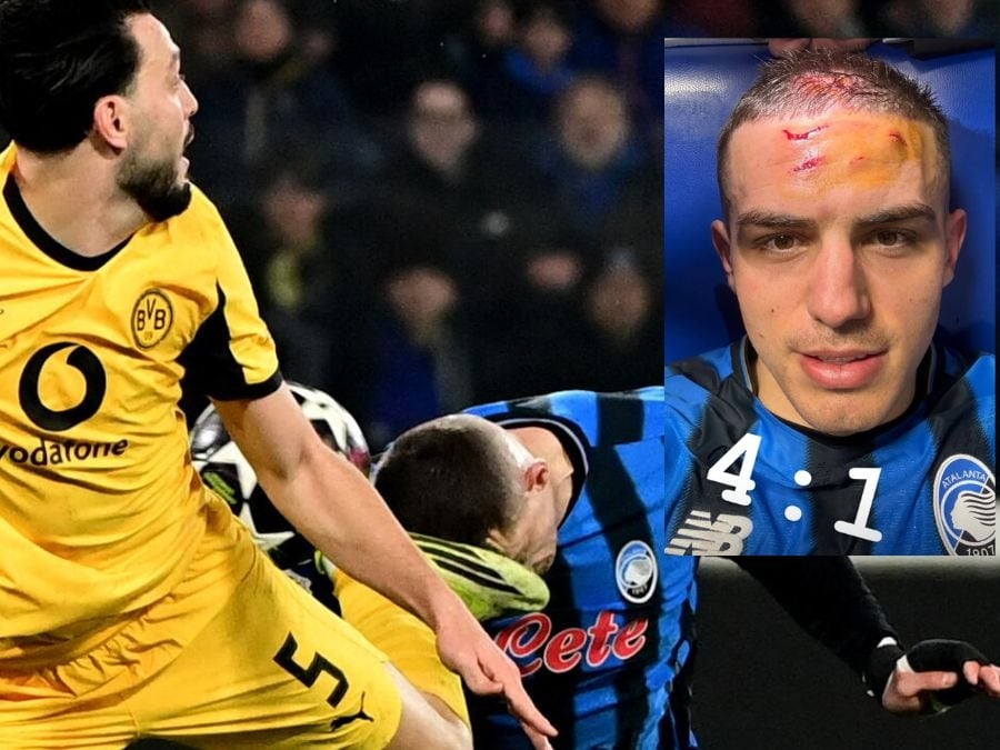 Así quedó el rostro de Nikola Krstović: patada... y a octavos