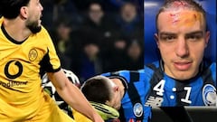 Así quedó el rostro de Nikola Krstović: patada... y a octavos