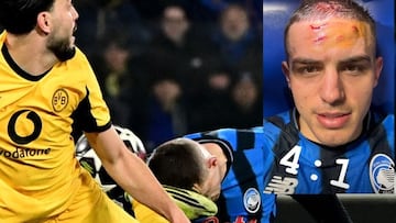 Así quedó el rostro de Nikola Krstović: patada... y a octavos