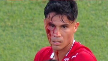 Galdames sufre una brutal patada en Argentina: quedó sangrando y no hubo ni amarilla