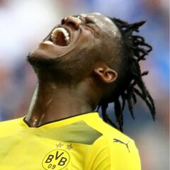 World Cup worry as Batshuayi stretchered off in Ruhr derby