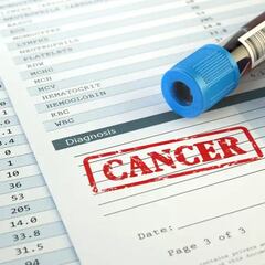 El presidente de la AECC: “Una de cada dos personas tendremos cáncer”