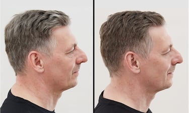 El fenómeno Alpecin Grey Attack: un champú reductor de canas Nº1 en Amazon