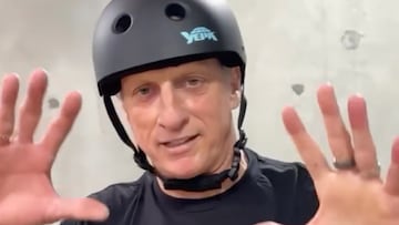 Tony Hawk enseñando su manos