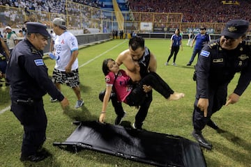 Un hombre transporta a una mujer herida a una camilla para que sea auxiliada, y transportada a una ambulancia, por la policía salvadoreña.