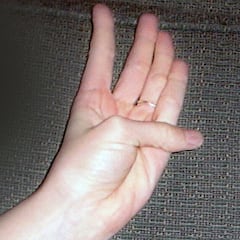 Cómo saber si tenemos una condición cardiovascular grave con un movimiento de dedo