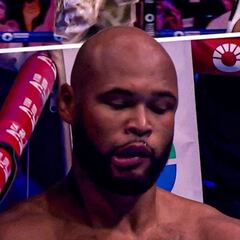 Frazer Clarke has jaw wired shut after brutal KO loss