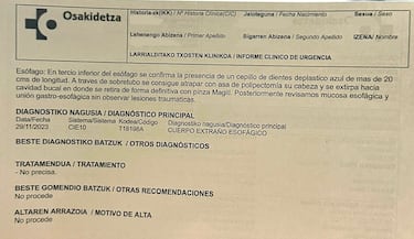 Se traga un cepillo de dientes al intentar sacarse una loncha de jam¨®n cocido
