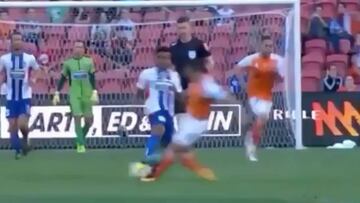 Tan escalofriante como aterrador: así se partió la tibia y el peroné