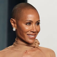 What is alopecia and why was Chris Rock joking about it with Jada Smith?