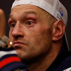 Is Tyson Fury at the end of his career?