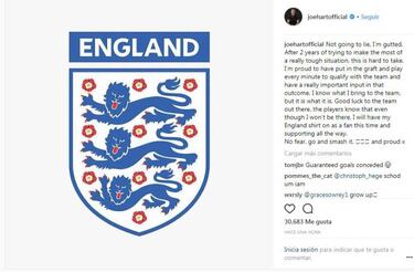 World Cup rejection hard to take, admits Joe Hart