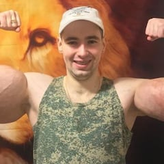 El 'Popeye Ruso' se somete a una nueva cirugía para salvar su vida tras inyectarse aceite