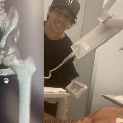 Grave accidente de Andreu Lacondeguy en Trentino