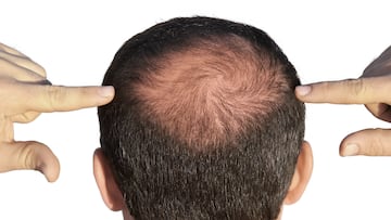 Ni minoxidil ni lociones: este champú con cafeína previene la caída del cabello y arrasa en Amazon España