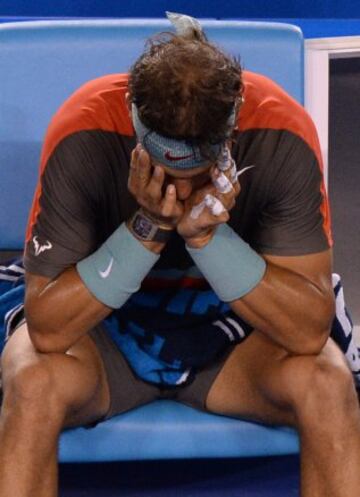 El tenista español está sufriendo de lo lindo en Australia.