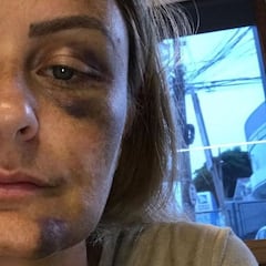 JP Azevedo agrede a Sara Taylor y su ex revela que la apalizó