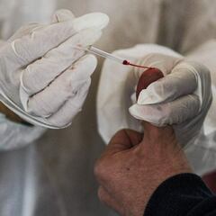 Un test de sangre predice las opciones de sobrevivir de un paciente COVID