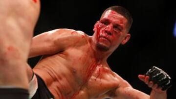 Nate Diaz tiene marca de 21-13. De sus victorias, 12 han sido por sumisi¨®n, cinco por knockout y cuatro por decisi¨®n.