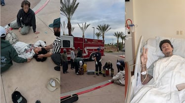 Nyjah Huston se fractura el cráneo y casi pierde un ojo