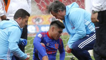 Los lesionados que preocupan a la U antes del Superclásico