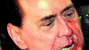 Berlusconi, sangrando.