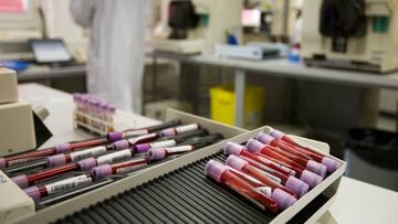 La AMA pide que cada federación “considere sus responsabilidades”