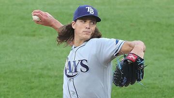 El abridor de Tampa Bay, abandonó el duelo de los Rays contra los White Sox y se le practicó una resonancia magnética en la articulación.