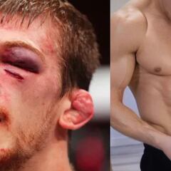 La recuperación express de Arnold Allen: ‘reconstrucción’ de abdomen para volver a la UFC