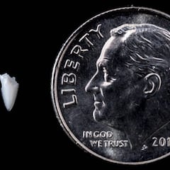 Un surfista descubre que le mordió un tiburón hace 25 años gracias a un diente