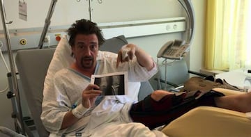 Richard Hammond muestra su fractura desde el hospital