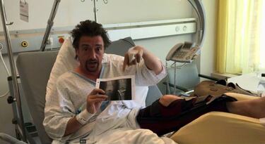 Richard Hammond, de Top Gear, sufre un grave accidente
