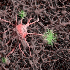 Científicos españoles y chinos logran revertir el Alzhéimer en ratones: se basa en un ‘recuerdo’ a los guardianes del cerebro