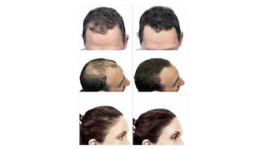 Ponle remedio a la calvicie con estas fibras capilares unisex, disponibles en siete tonos