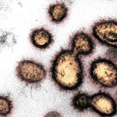 Coronavirus: ¿cuánto puede durar en el cuerpo humano?
