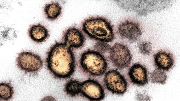 El coronavirus, a vista de microscopio.